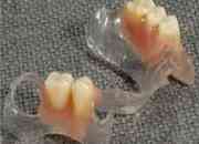 Reparacin y fabricacion protesis dentales segunda mano  Chile